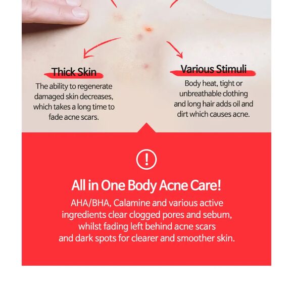 TIA'M, Anti Blemish Body Lotion Back & Chest 200ml - Picture 9 of 12